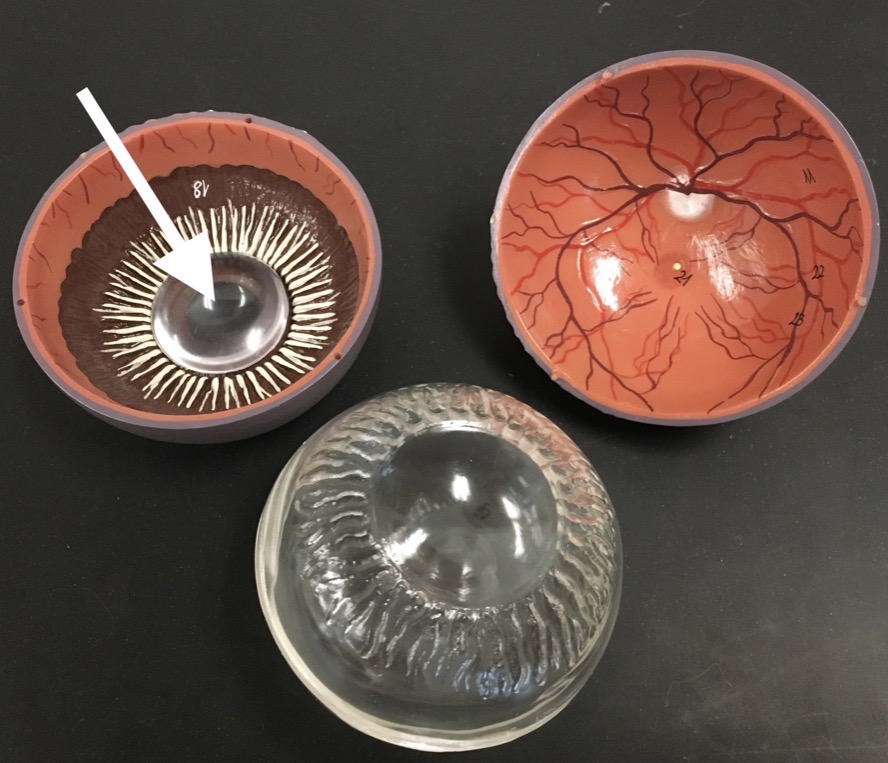 <p><span>name the CLEAR structure at the end of the arrow's point</span></p>