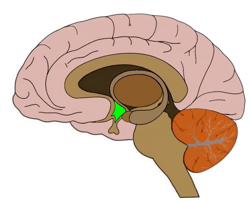 term image
