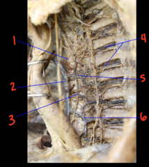 <p>What is labeled 3?</p>