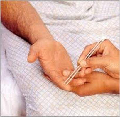 <p></p><ul><li><p>Assessing if the patient identify between one vs two points</p><ul><li><p>Either will place 1 point or 2 points on the hand at the same time</p></li></ul></li><li><p>We are looking for <strong>80% accuracy</strong> (or about 5 correct responses)</p></li><li><p>Usually is used on the hand </p></li></ul><p></p>