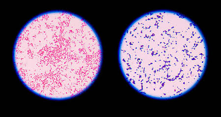 <p>negative gram stain: which one</p>