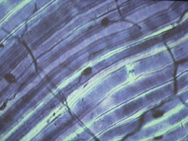 <p>What are the linear structures in this image?</p>