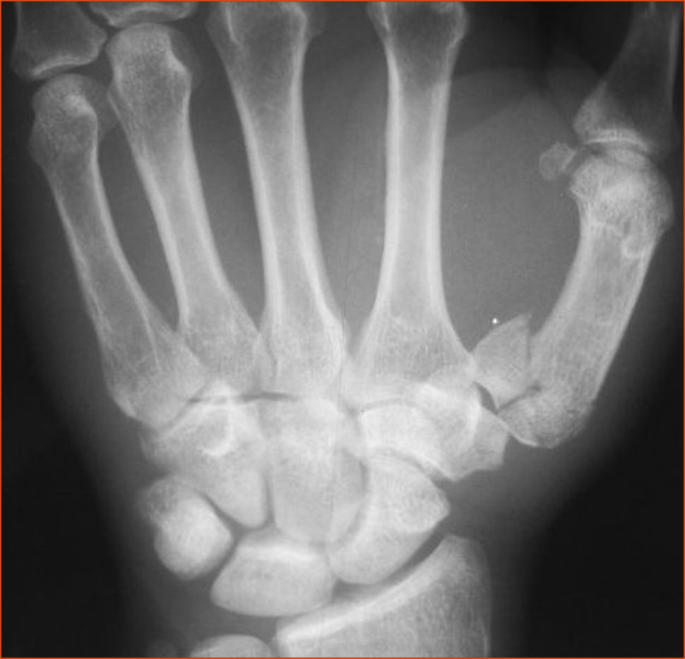 <p>What is the diagnosis?</p>