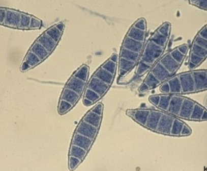 <p>Scalp and skin infections</p><p>Oval macrocondida</p>