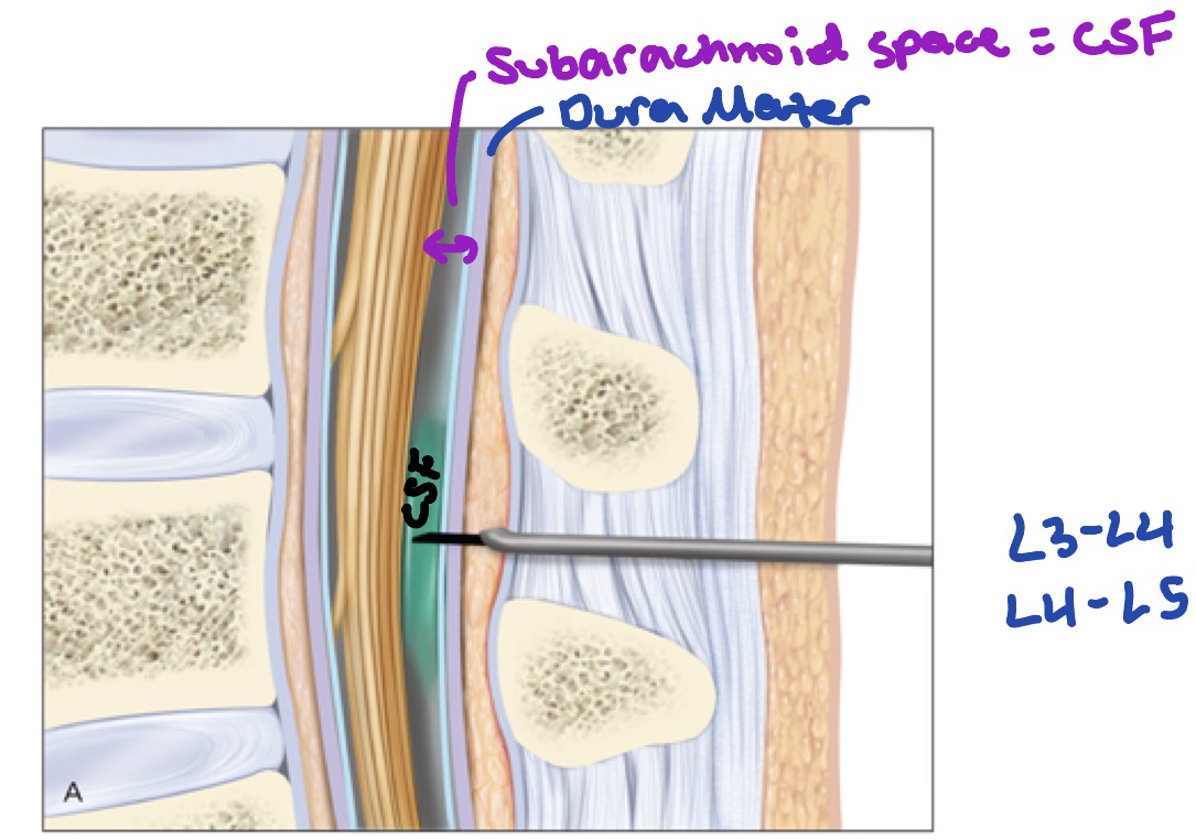 <p>L3-L4</p><p>L4-L5</p>