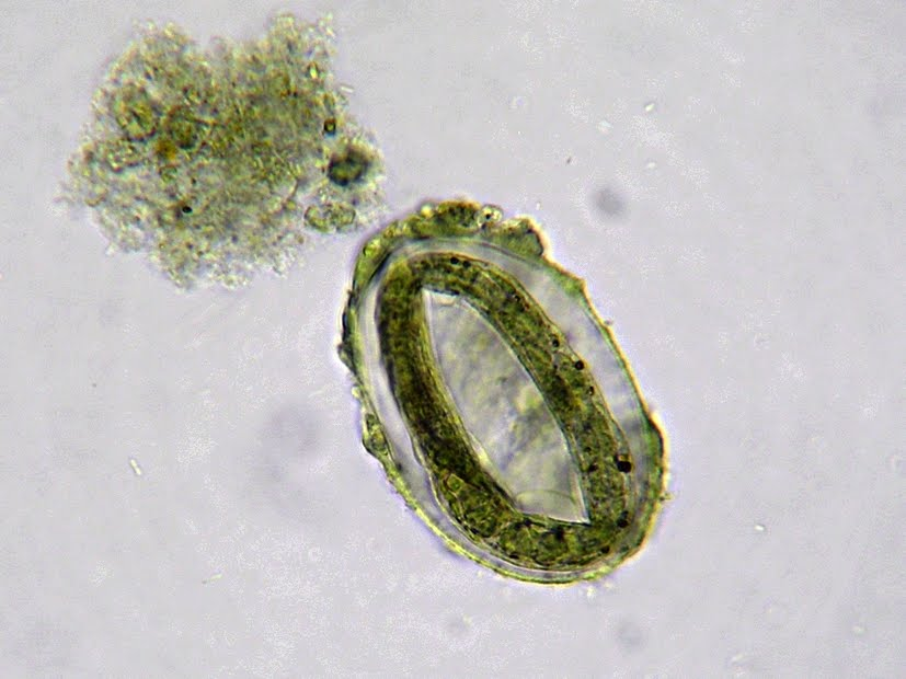 <p>Threadworms? </p><p>Route of infection = wound/lesion of skin → blood → lungs → duodenum</p><p>Egg looks like that hillary clinton donut meme</p>