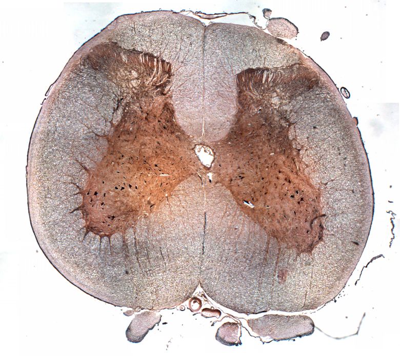 <p>Identifica la plaquita</p>