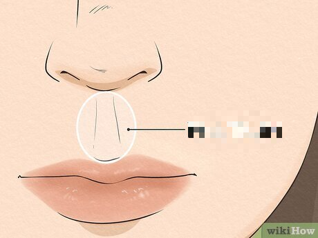 <p>the following picture is what extraoral landmark?</p>