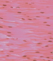 <p>- non-striated </p><p>- involuntary</p>