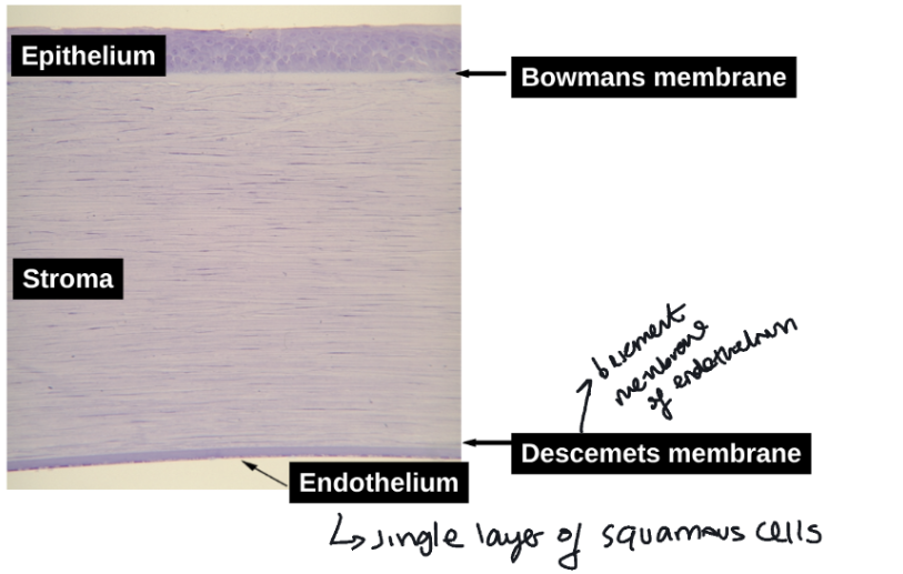 <p>epithelium</p><p>bowmans membrane</p><p>stroma</p><p>descemets membrane</p><p>endothelium</p>