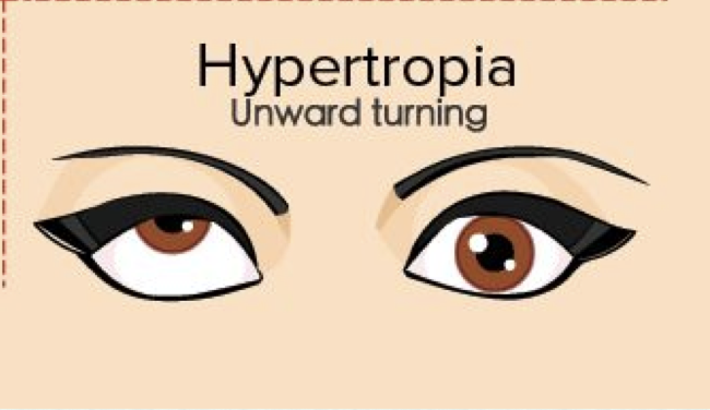 <p>unward turning </p>