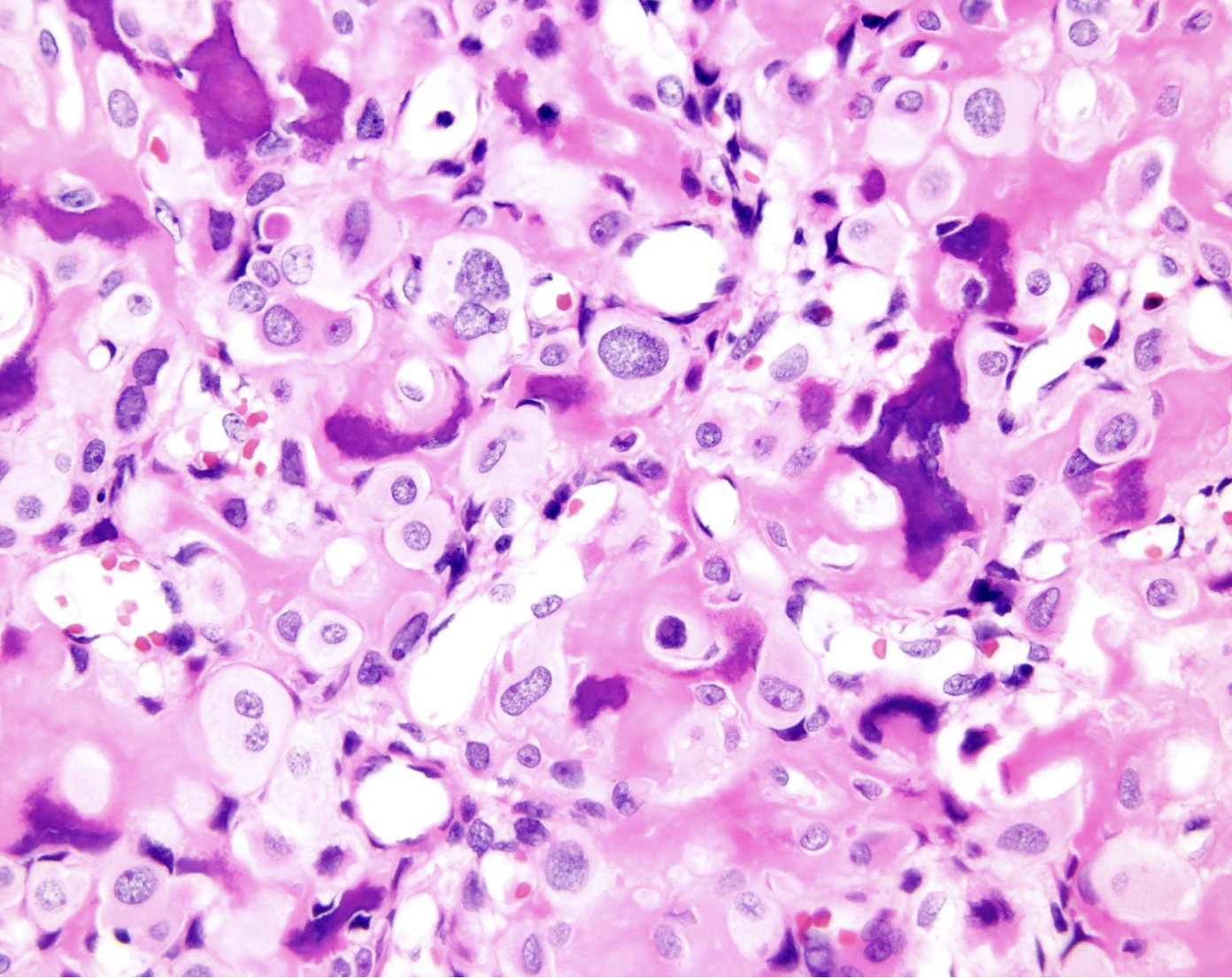 <p>tumeur humérus jeune homme</p><p>diagnostic</p><p>définition</p><p>age</p><p>topographie</p><p>anatomie</p><p>histologie</p><p>IHC moléculaire</p><p>DD</p>