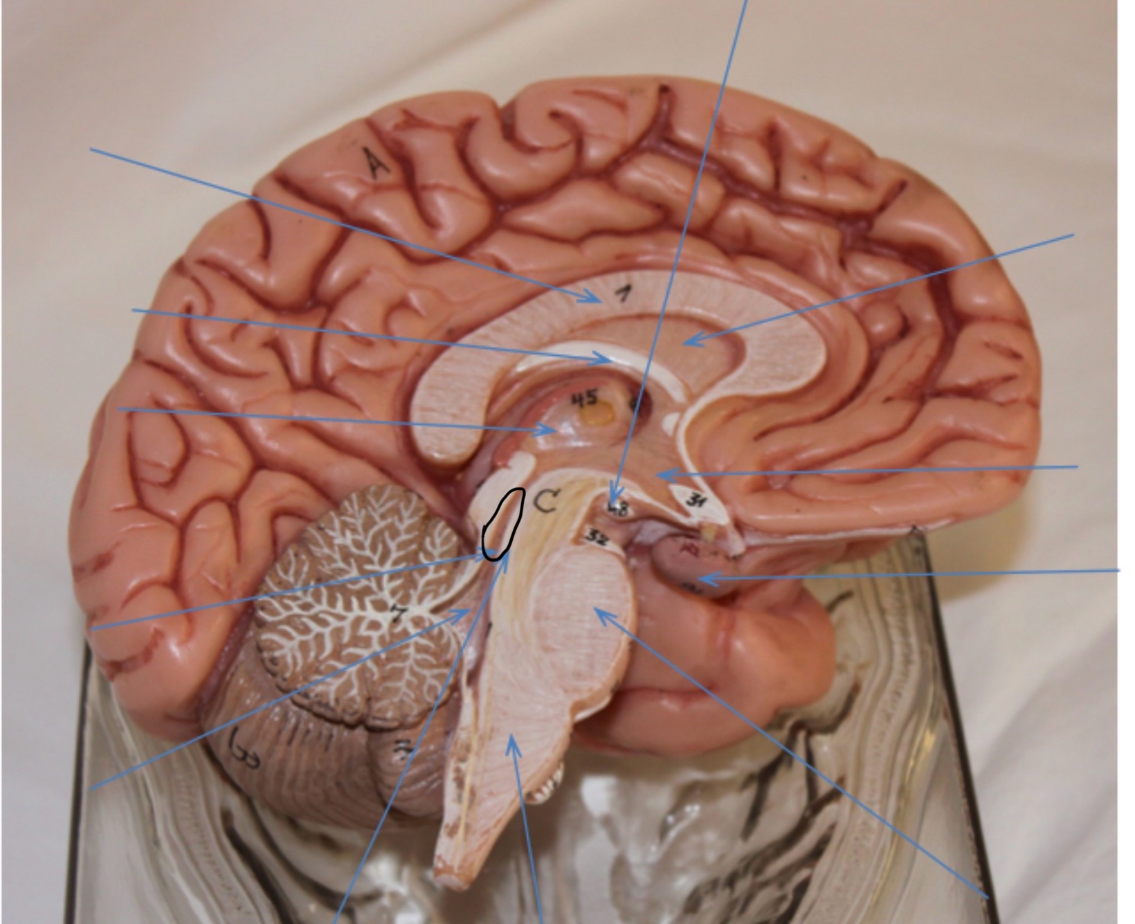 <p>Identify the circled area?</p>