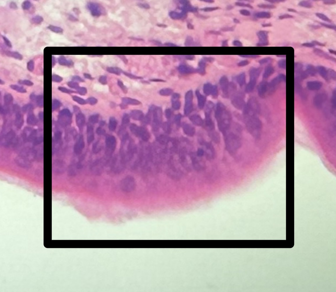 <p>This tissue lines the nasal cavity and nasopharynx.</p>