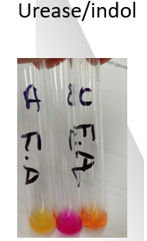 <p>Bepaalt of bacteriën het enzym urease produceert.</p><ul><li><p>Urease splitst ureum in ammoniak en koolstofdioxide en de toename in ammoniak zorgt voor een verhoging van de pH.</p></li><li><p>Fenolrood wordt meestal als pH-indicator gebruikt.</p></li><li><p>Ureasepositief → vorming ammoniak en verhoging van de pH → dieproze, rode kleur</p></li><li><p>Ureasenegatief → geen vorming van ammoniak en geen verhoging van de pH → geel, oranje kleur blijft behouden</p></li><li><p>Oorspronkelijke pH was neutraal, eerder zuur → vandaar reeds in het begin geel, oranje </p></li></ul><p></p>
