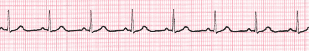 <p>What rhythm is this?</p>