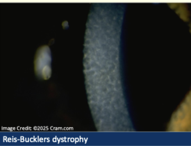 <p>Describe and give diagnosis</p>