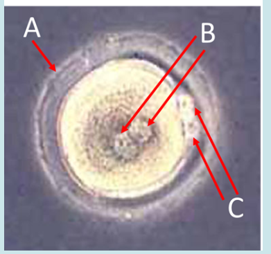 <ol><li><p>Label A, B and C</p></li><li><p>Where is this structure normally located in the female body?</p></li><li><p>What triggers the second structure C to develop?</p></li><li><p>How many chromosomes are contained in B?</p></li><li><p>How many chromosomes are contained in C?</p></li><li><p>What process immediately follows the joining of structures B?</p></li></ol><p></p>