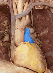 <p>identify the structure</p>