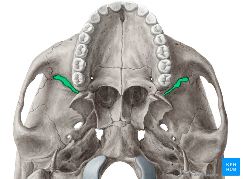 term image