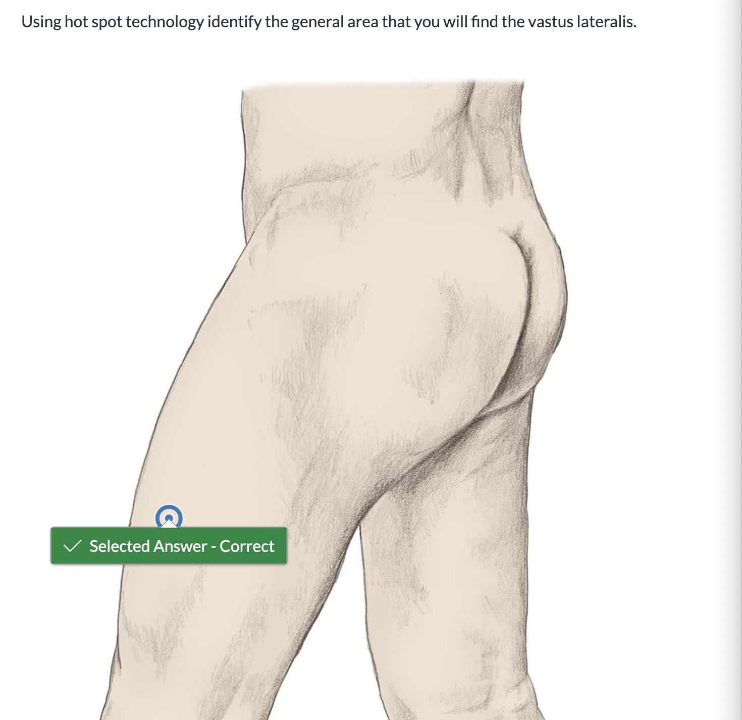 <p><span>Using hot spot technology identify the general area that you will find the vastus lateralis.</span></p>