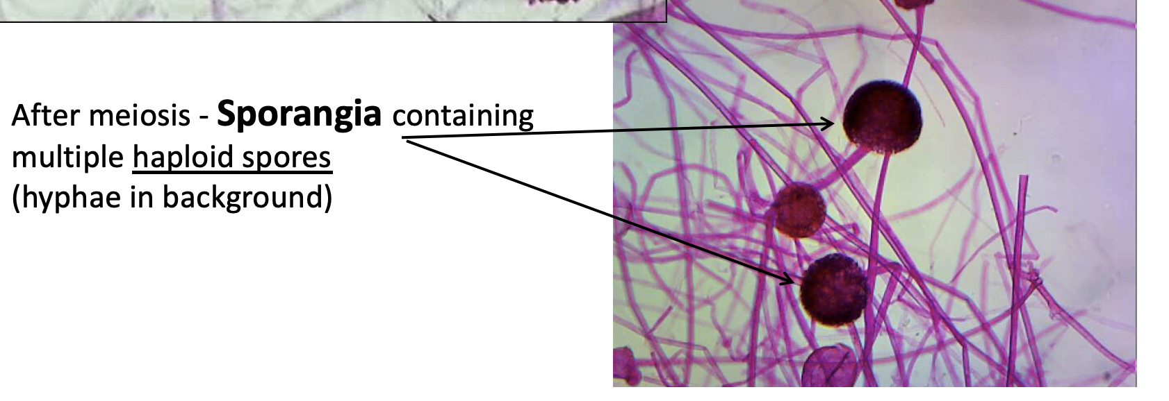 <p>This is the <strong>sporangia</strong> after <strong>meiosis</strong> in zygomycota </p><p>Contains multiple <strong>haploid</strong> <strong>spores</strong> </p><p>The hyphae is in the background </p>
