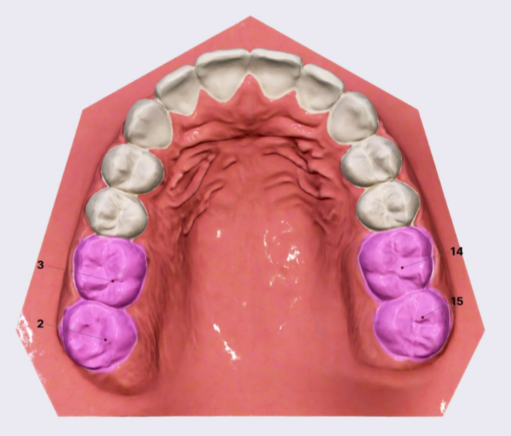 term image