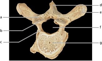 <p>Identify the bone marking labeled “c.”</p><p>a. costal facet</p><p>b. spinous process</p><p>c. lamina</p><p>d. pedicle</p>