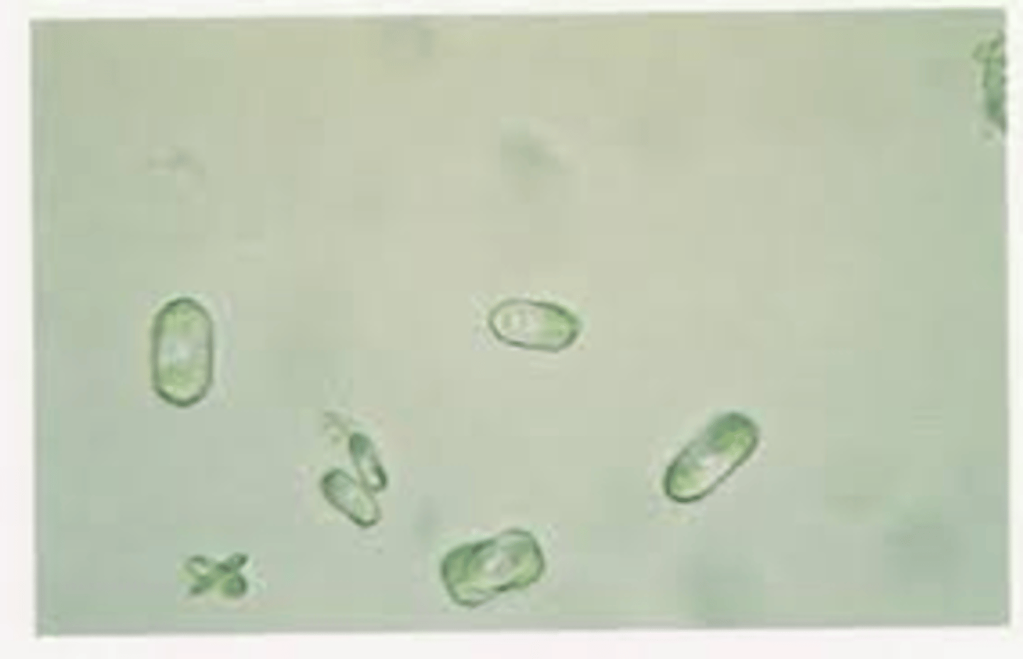 <p>pH <7.5</p>