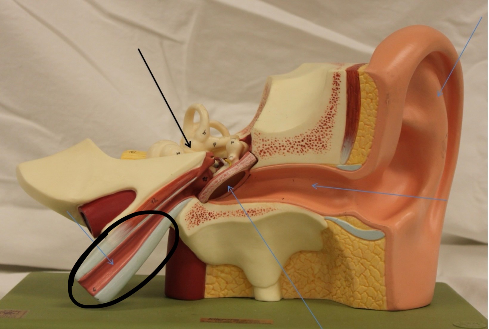 <p>Identify the circled area?</p>