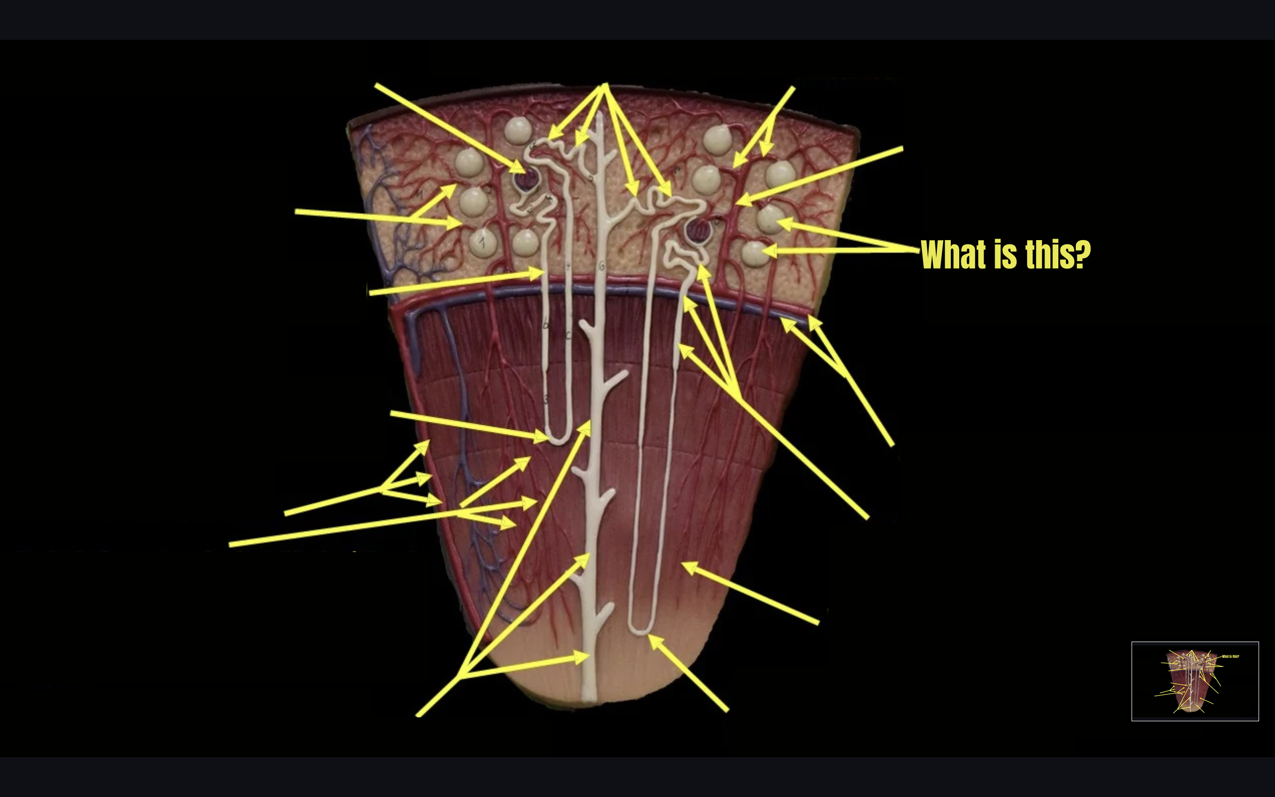 term image