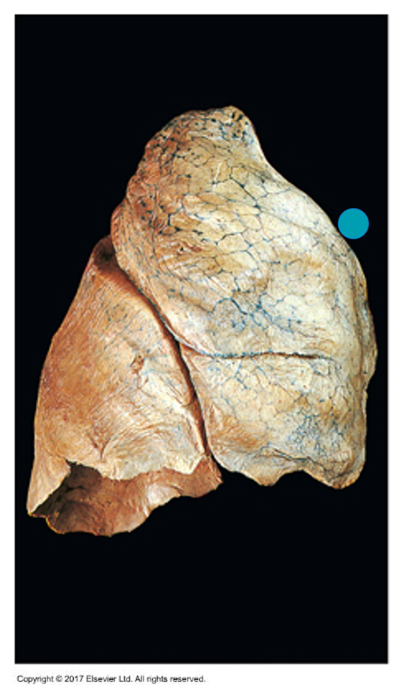 <p>What does the blue dot indicate?</p>