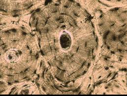 <p>Basic structural unit of lamellar bone</p>