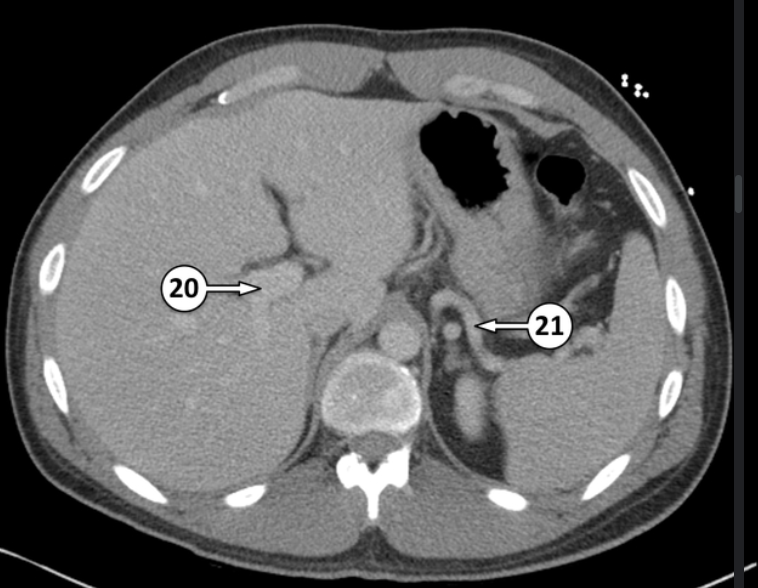<p>20 and 21 are both blood vessels. Label which blood vessels they are </p>