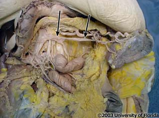 <p>what vein is pictured here?</p>
