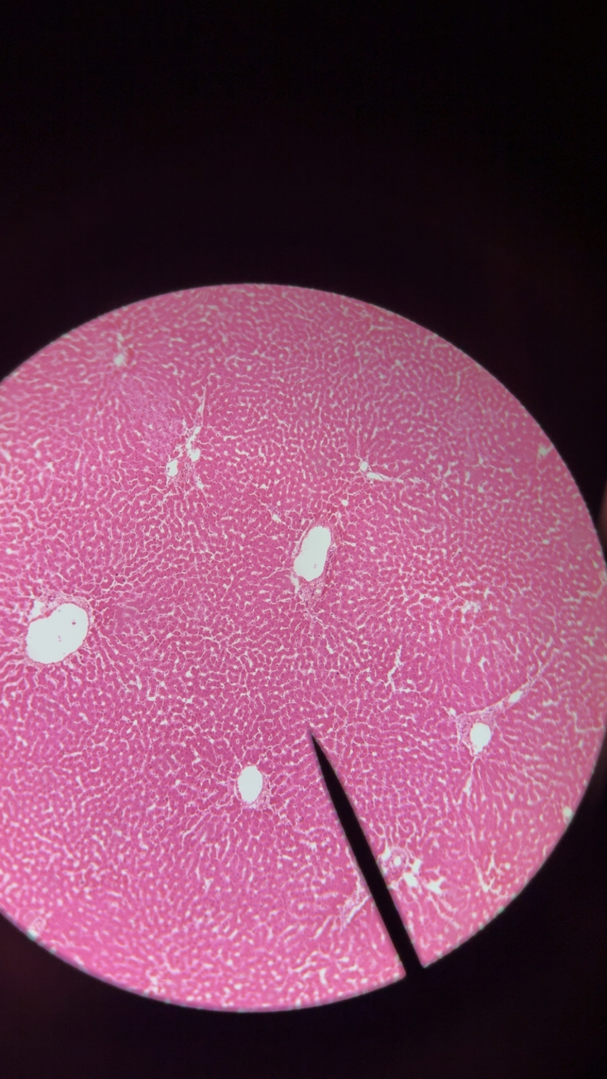 <p>liver lobule 3 components </p>