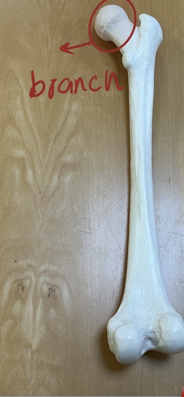 <p>Name and Type of this bone </p>