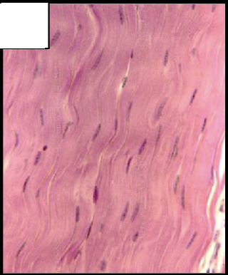 <p>Collagen fibers arranged in parallel bundles</p>