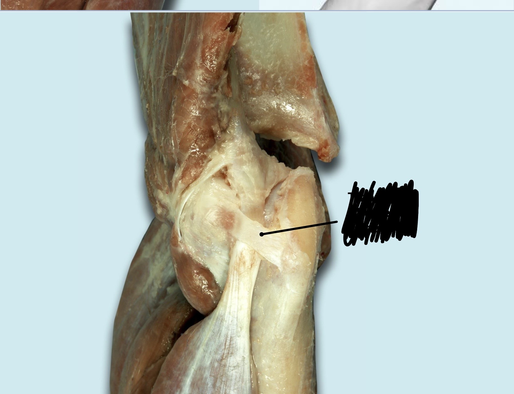 term image