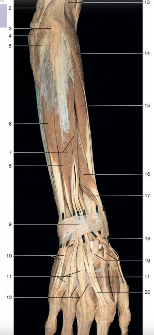 <p>Pinche 16</p>