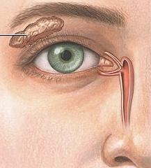 term image