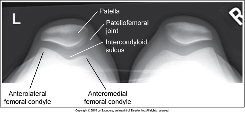 <p>patella</p>