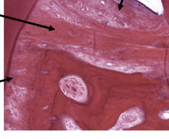 <p>ID the fibers (top Left arrow)</p>