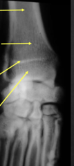 <p>What is the arrow second from the bottom pointing to?</p>