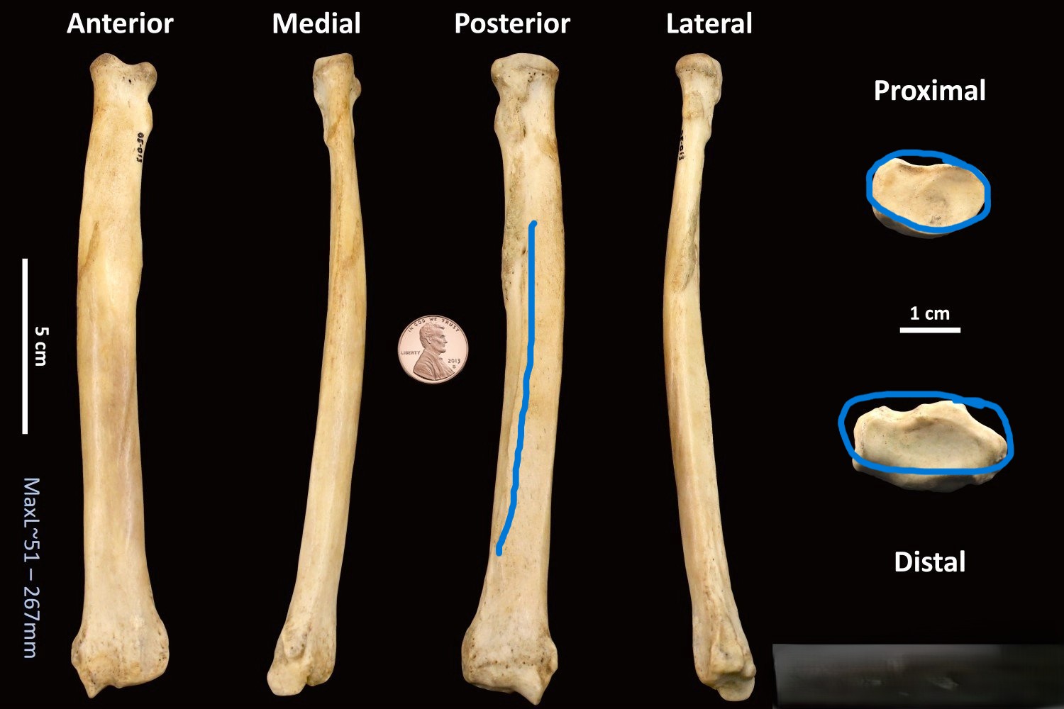 <ul><li><p>un-divided articulations </p></li><li><p>posterior ridge </p></li></ul><p></p><p>dog radius </p><p></p>