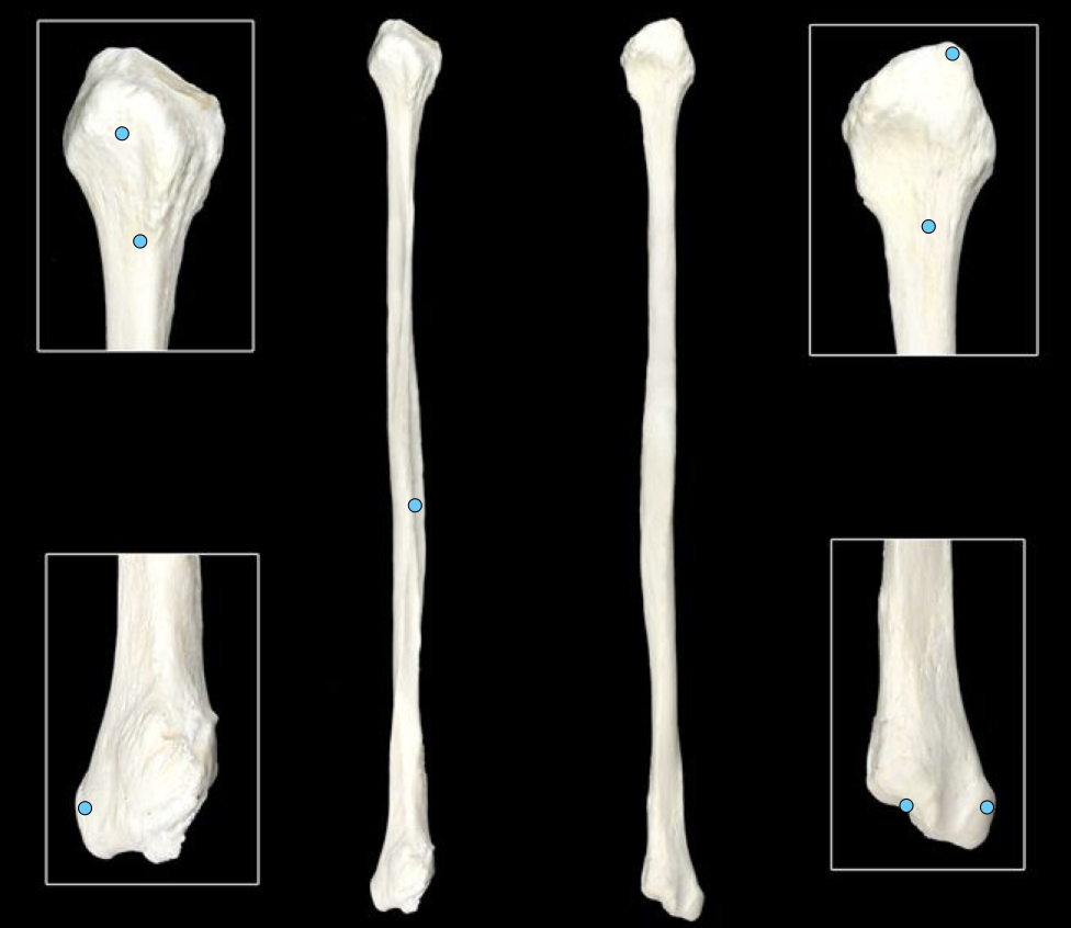 <p>lateral bone of lower leg</p>