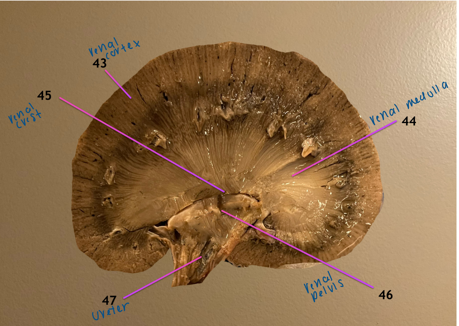 <ol start="43"><li><p>renal cortex</p></li><li><p>renal medulla</p></li></ol><p>.</p><ol start="47"><li><p>ureter</p></li></ol><p></p>