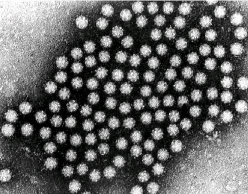 <p>What is this Waterborne Virus?</p><p>-<strong>Astrovirus</strong></p>