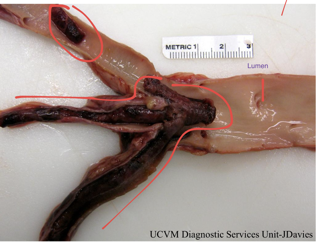 <p>describe and name this clot </p>