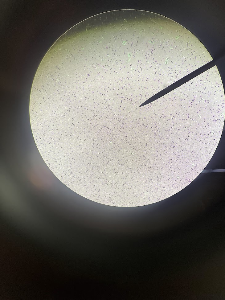 <p>tissue types above/below pointer</p>